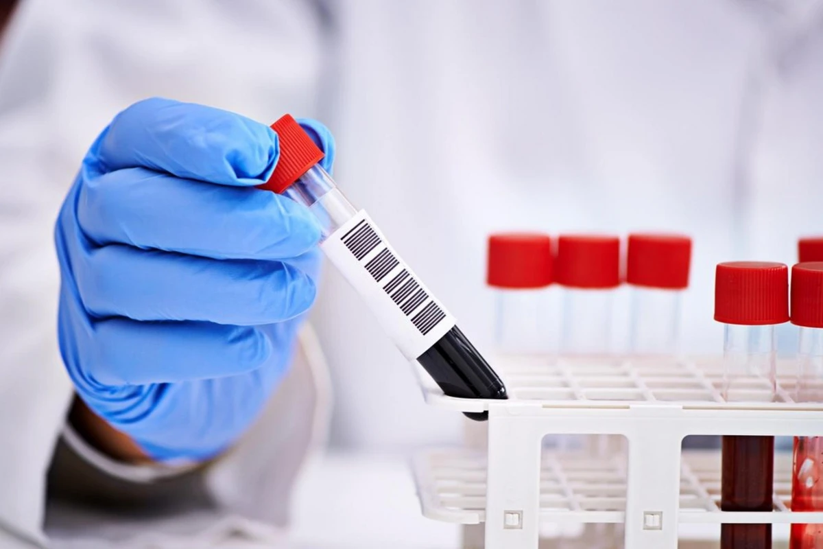 Azərbaycanda icra başçısının müavini və xanımı koronavirusa yoluxdu Azərbaycanda icra başçısının müavini və xanımı koronavirusa yoluxdu