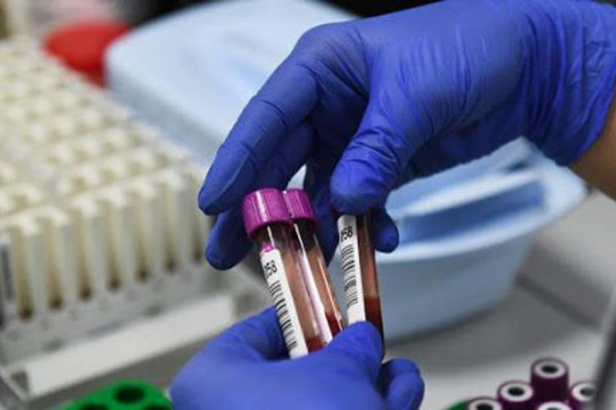 Azərbaycanda koronavirus xəstələri üçün ümid: 14 nəfər... - VİDEO