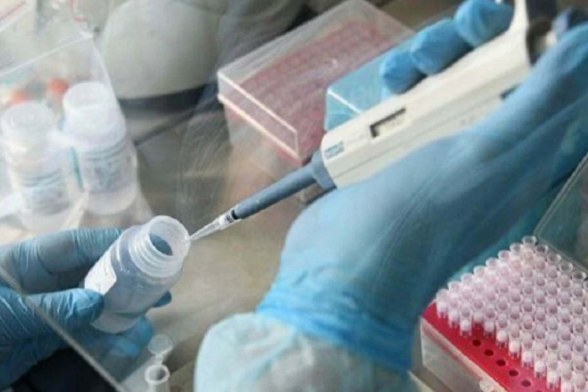 Deputatların koronavirus testinin nəticələri açıqlandı Deputatların koronavirus testinin nəticələri açıqlandı