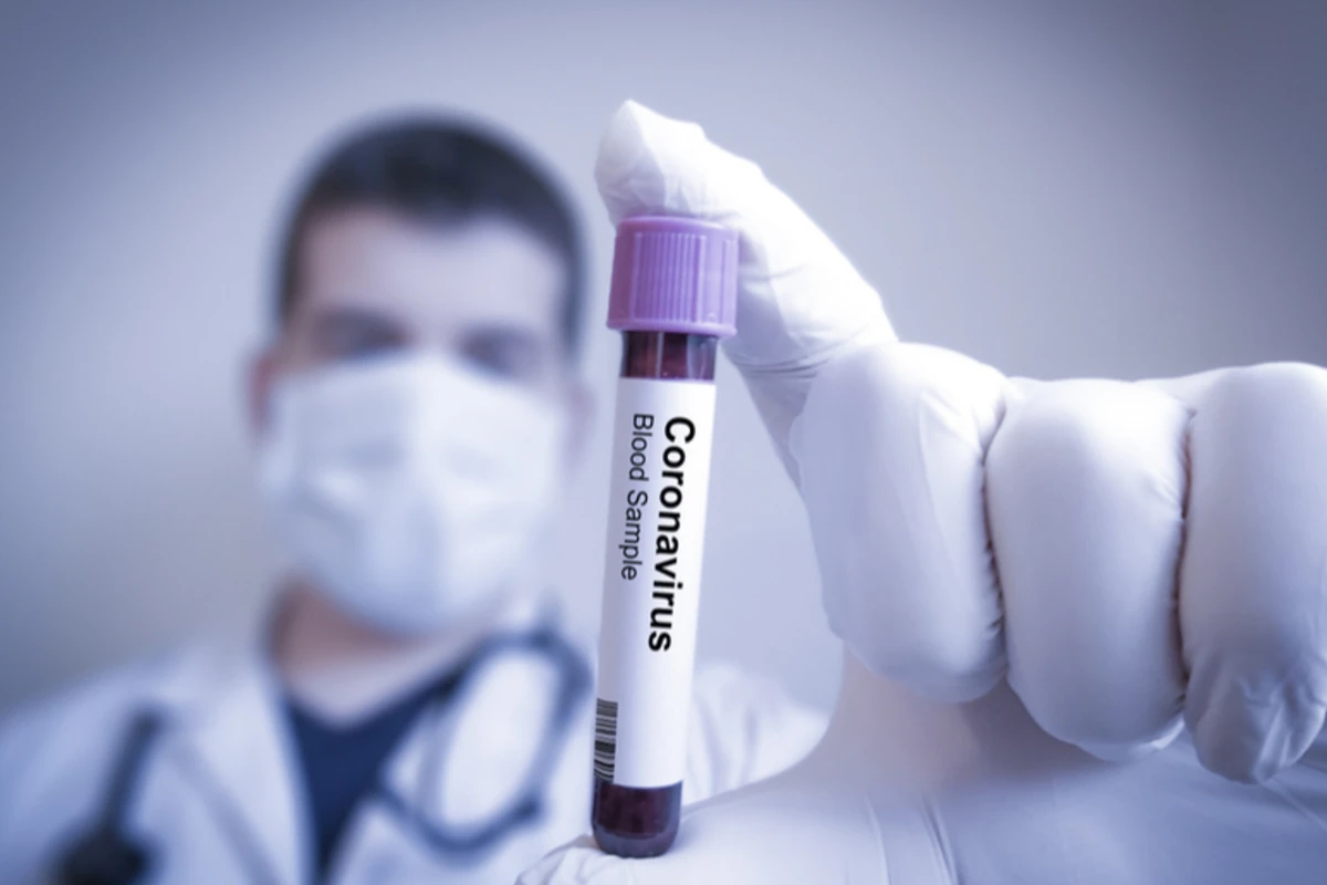 Azərbaycanda sağlam şəxsə koronavirus xəstəsi olması barədə SMS gəldi
