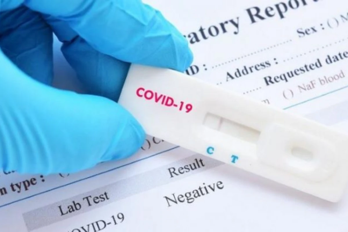Almaniya şirkəti Azərbaycana koronavirus testləri ixrac etmək niyyətindədir