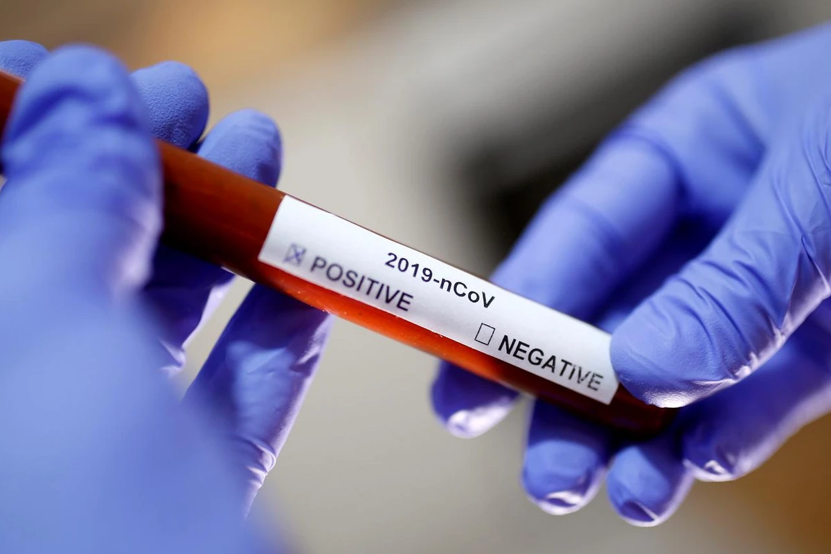 Koronavirus Azərbaycanın hansı bölgəsində daha çox yayılıb? - STATİSTİKA