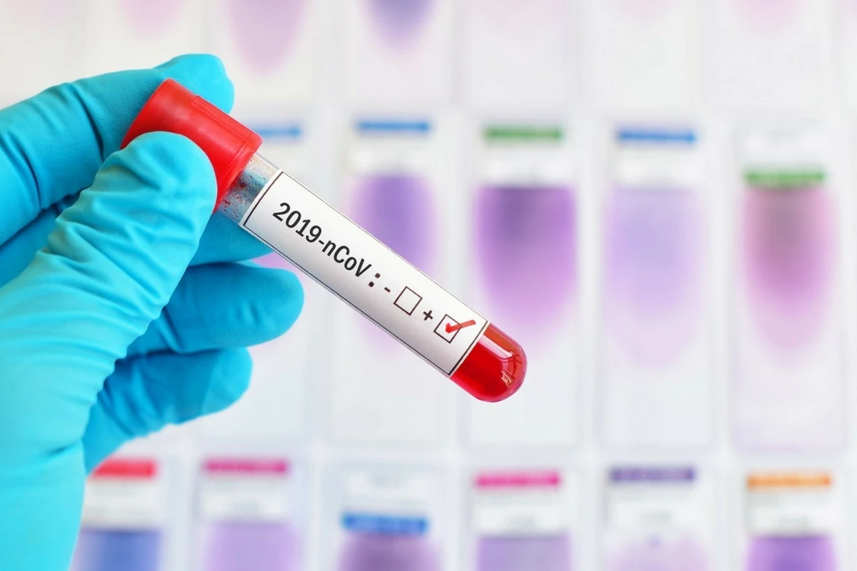 Koronavirus xəstəliyinin ağırlıq dərəcəsi açıqlandı - RƏSMİ