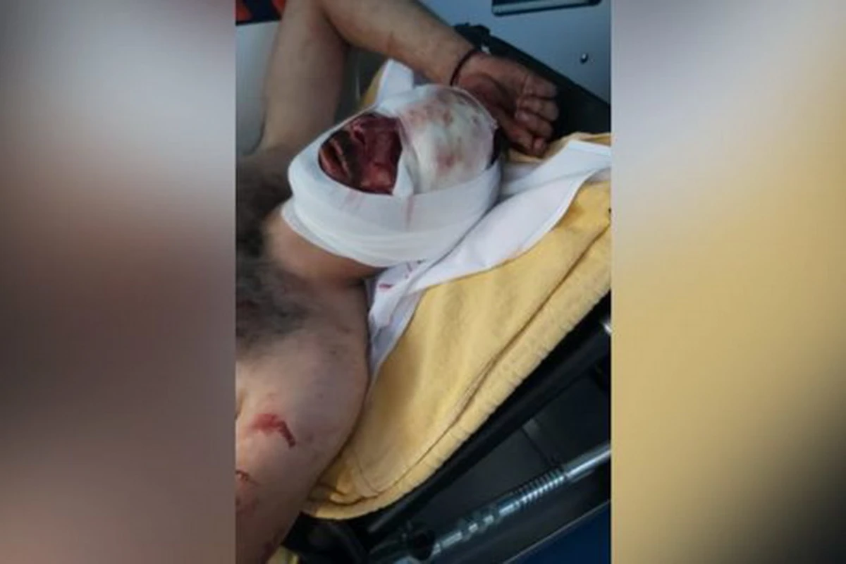 Зверства армян против азербайджанцев в Бельгии – ВИДЕО 18+
