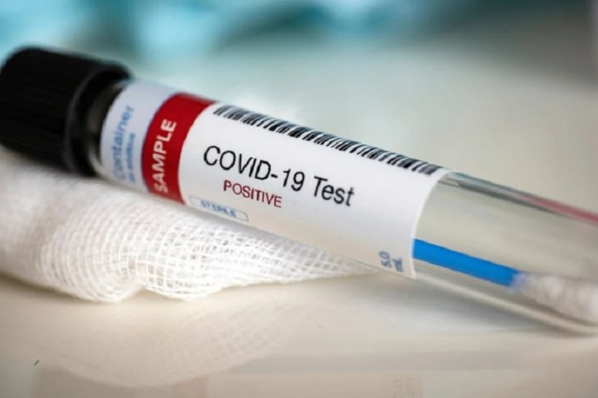 Стал известен процент заражения COVID-19 по регионам Азербайджана