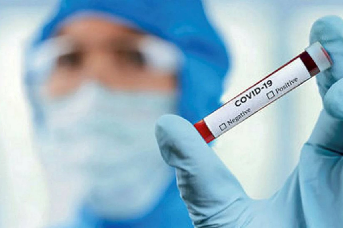 Özəl klinikalarda koronavirus testinin qiyməti necə müəyyən olunur? Özəl klinikalarda koronavirus testinin qiyməti necə müəyyən olunur?