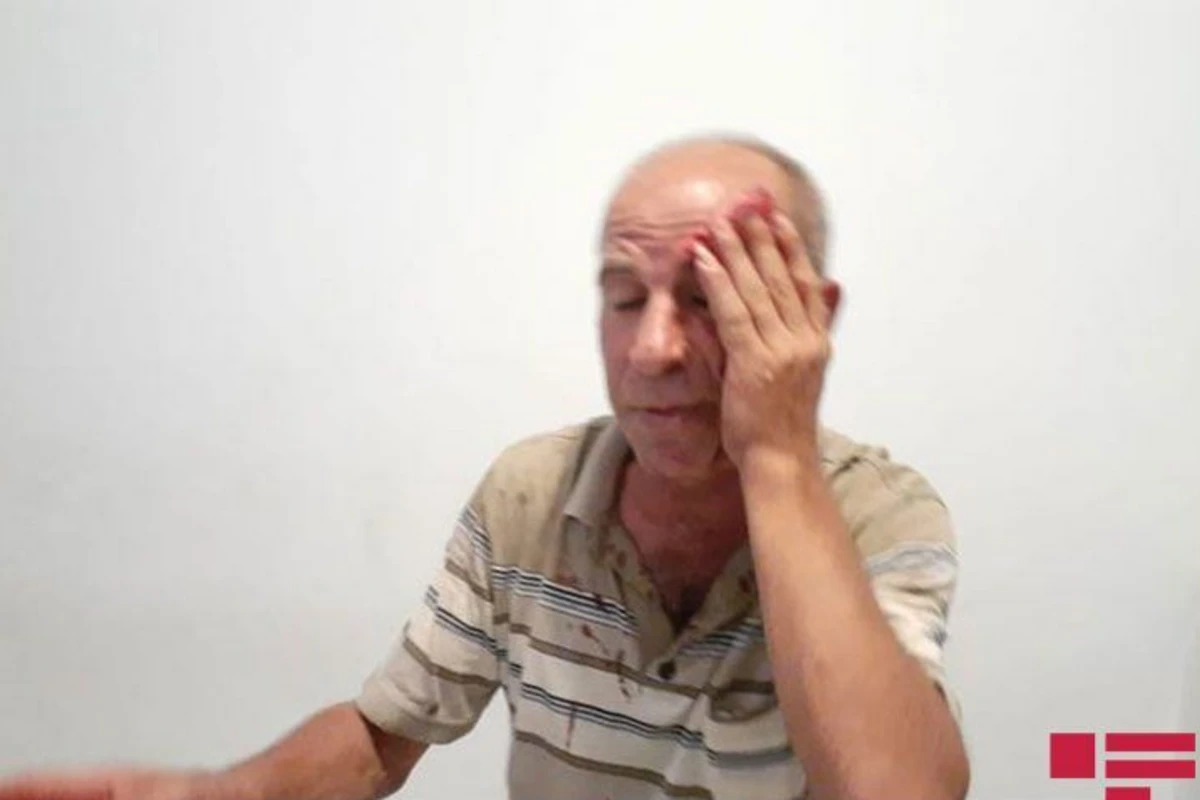 Xalq artistinin qardaşı döyüldü - FOTO Xalq artistinin qardaşı döyüldü - FOTO