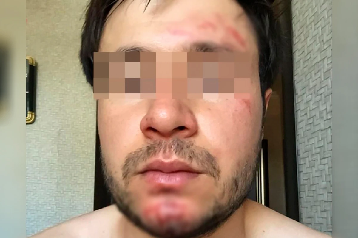 “Pul vermədim deyə baş həkim məni yumruqladı” - FOTO - YENİLƏNİB
