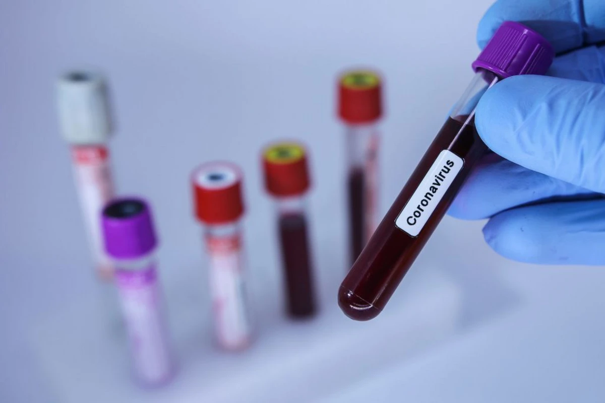 Daha 20 şagirddə koronavirus aşkarlandı - RƏSMİ