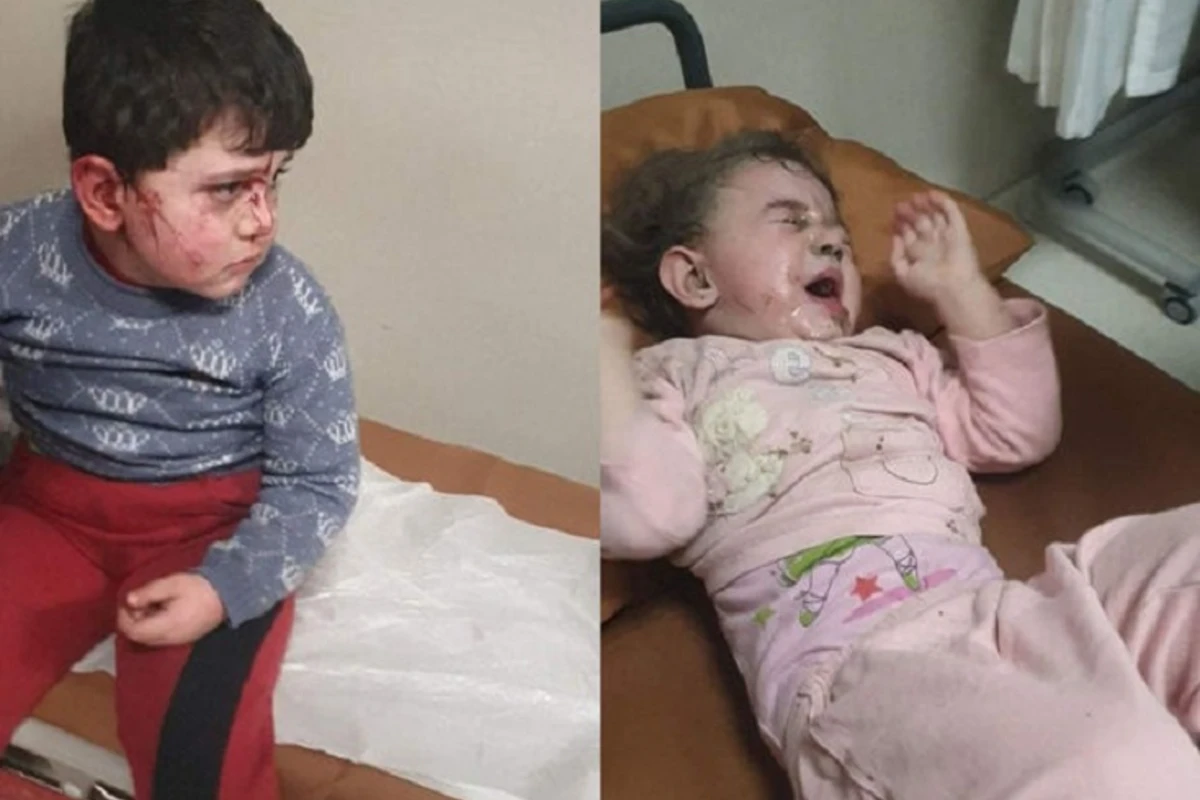 Среди пострадавших в результате вражеского обстрела Гянджи есть малолетние дети – ВИДЕО