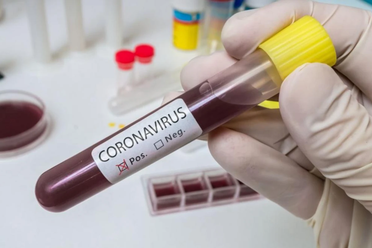Ermənistanda koronavirus tüğyan edir Ermənistanda koronavirus tüğyan edir