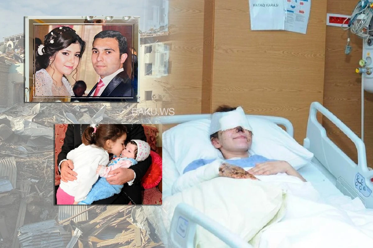 Gəncə terrorunda gözlərini itirən Pərvin - O, bir daha balalarını görməyəcək - FOTO Gəncə terrorunda gözlərini itirən Pərvin - O, bir daha balalarını görməyəcək - FOTO