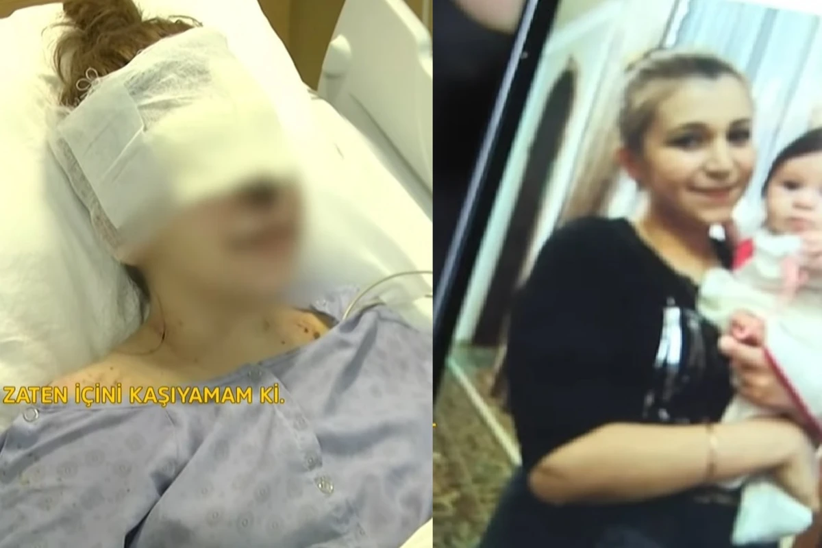 Gəncə terrorunda gözlərini itirən Pərvin: Oyandım ki, torpağın altındayam - VİDEO Gəncə terrorunda gözlərini itirən Pərvin: Oyandım ki, torpağın altındayam - VİDEO
