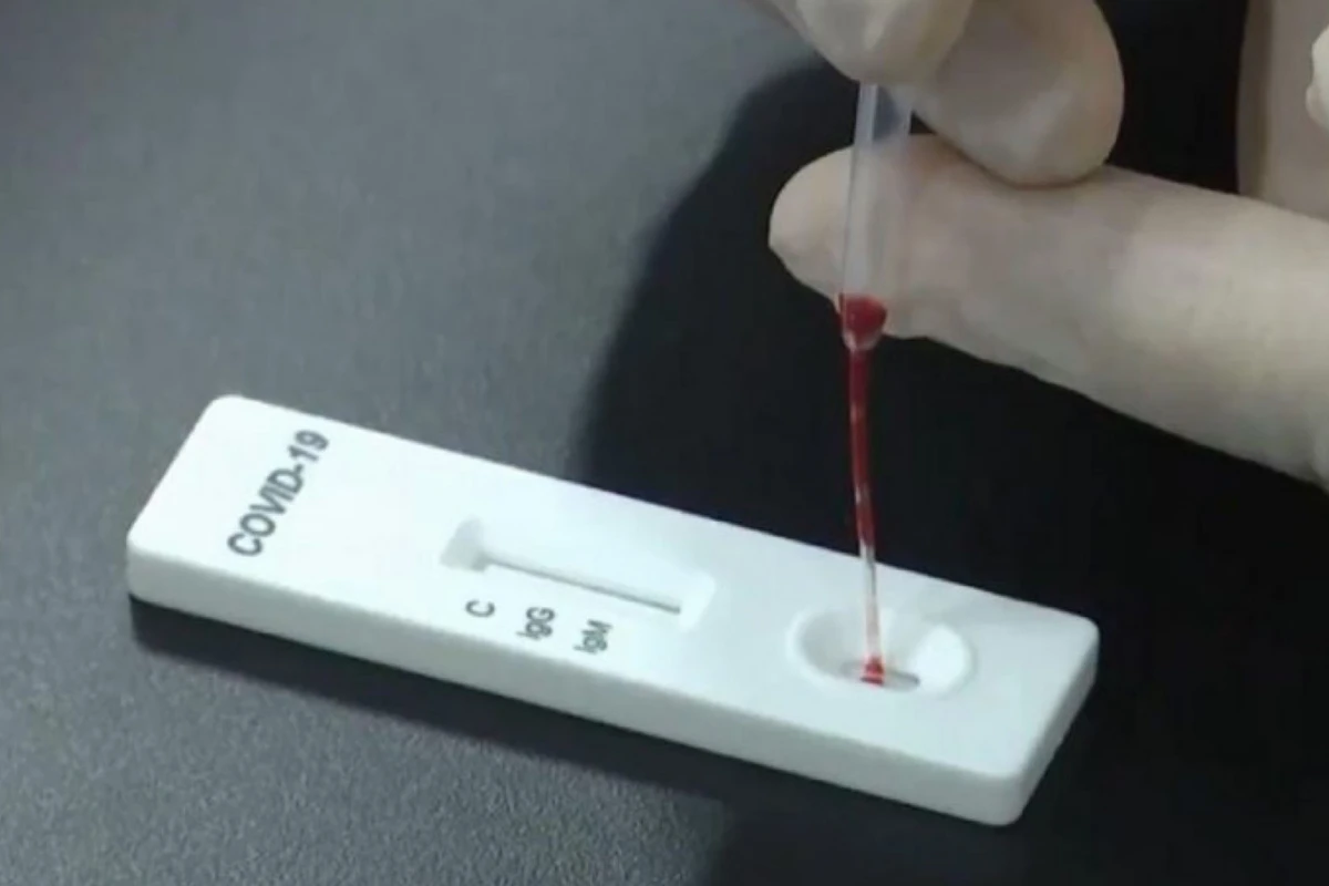 ABŞ-da 30 dəqiqə ərzində nəticə verən koronavirus testinin evdə istifadəsinə icazə verildi - VİDEO