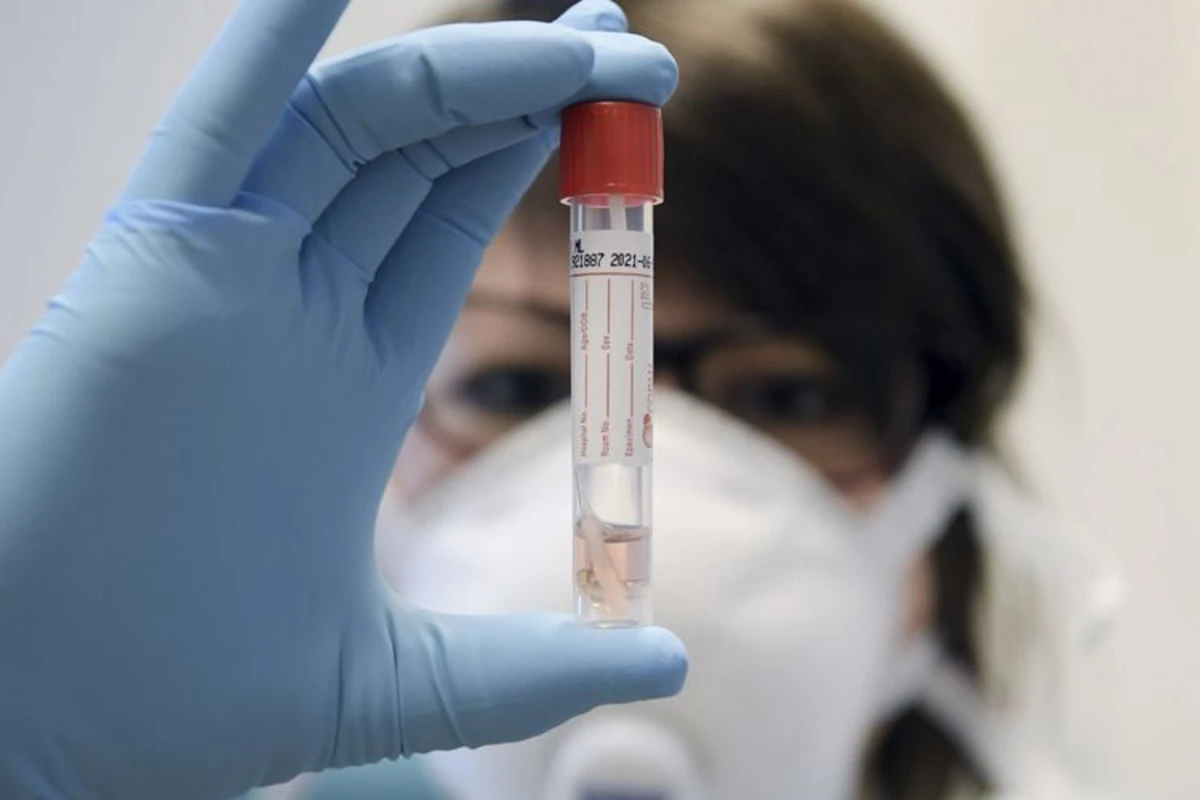 Azərbaycanda simptomsuz təmaslılardan koronavirus testi götürülməsinə müvəqqəti məhdudiyyət qoyulub Azərbaycanda simptomsuz təmaslılardan koronavirus testi götürülməsinə müvəqqəti məhdudiyyət qoyulub