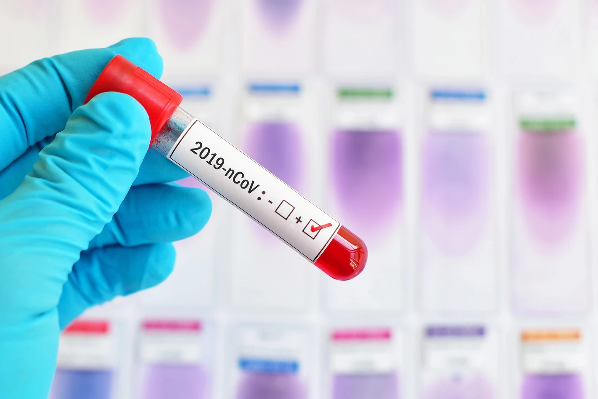 Dünən 28 koronavirus xəstəsi yaşayış yerini tərk edib