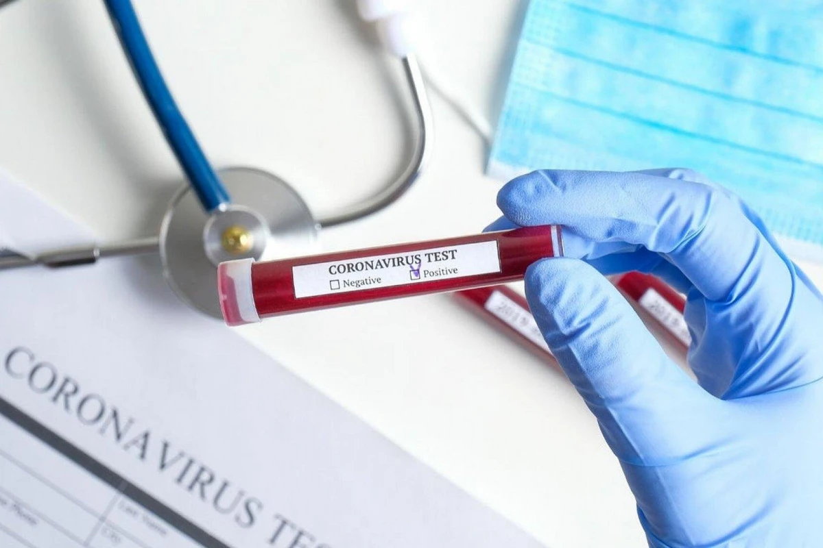 Mağazada satıcı işləyən şəxsdə koronavirus aşkarlandı