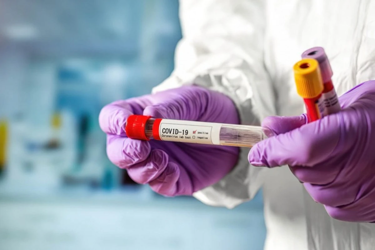 Deputat: Koronavirus testlərinin qiyməti aşağı salınmalıdır