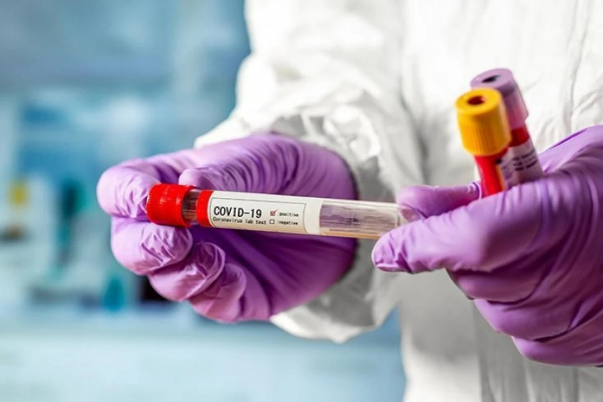 Выявлено заболевание, повышающее риск смерти от COVID-19 почти в три раза