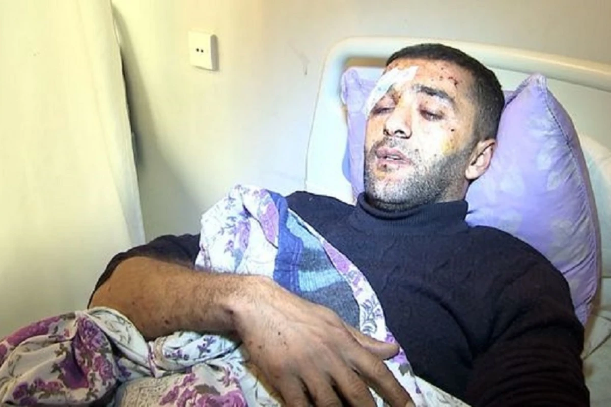 Tərtərdə minaya düşən traktorçu: “Əlim, üzüm qan içində idi” - VİDEO