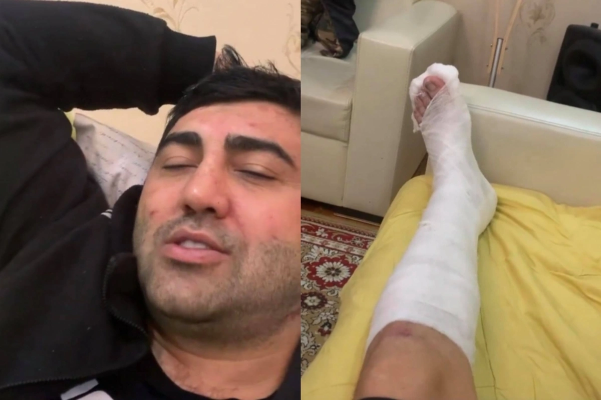 Müğənni Vüqar Muradovun ayağı sındı - Əməliyyat olunacaq
