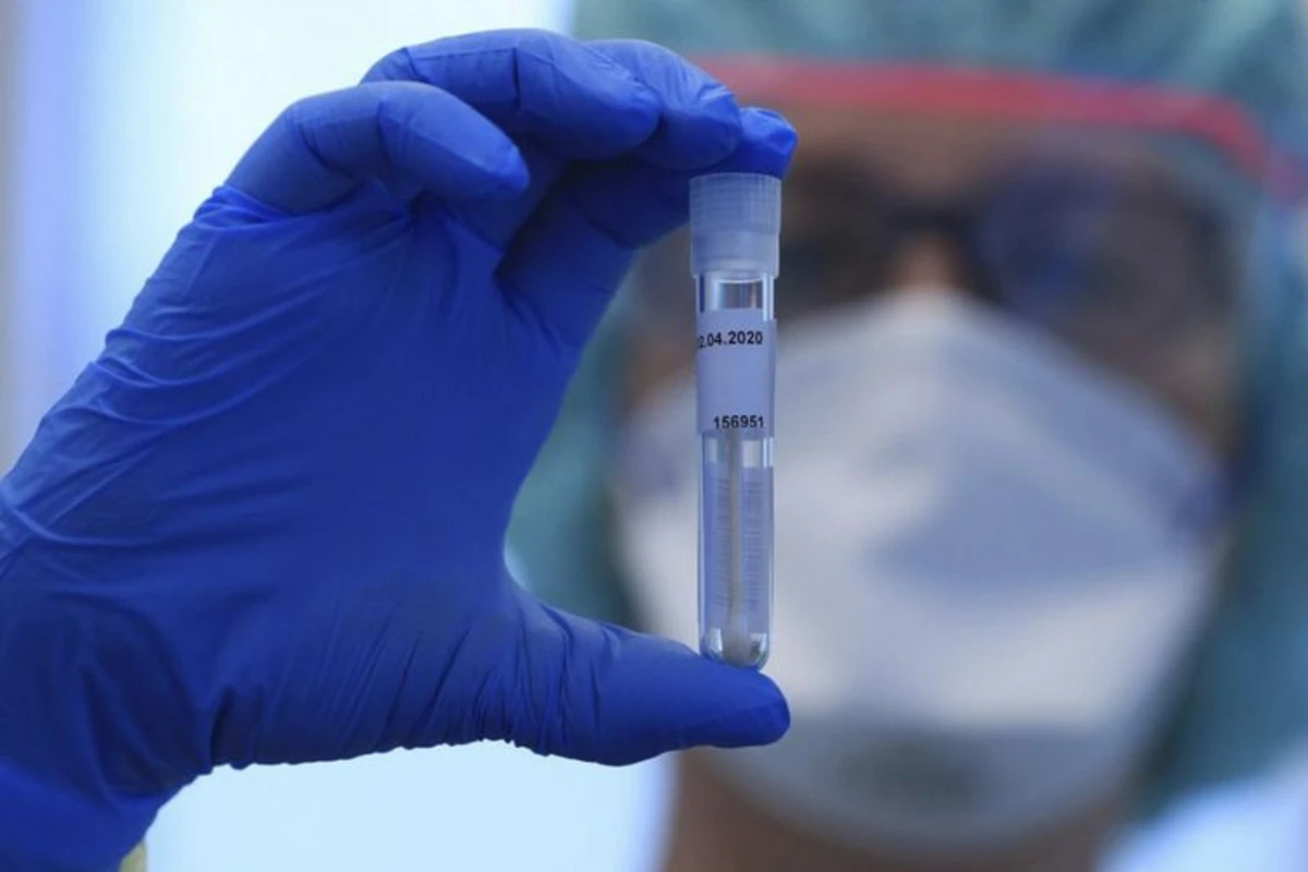 Azərbaycanda son sutkada koronavirusa yoluxanların sayı açıqlandı Azərbaycanda son sutkada koronavirusa yoluxanların sayı açıqlandı