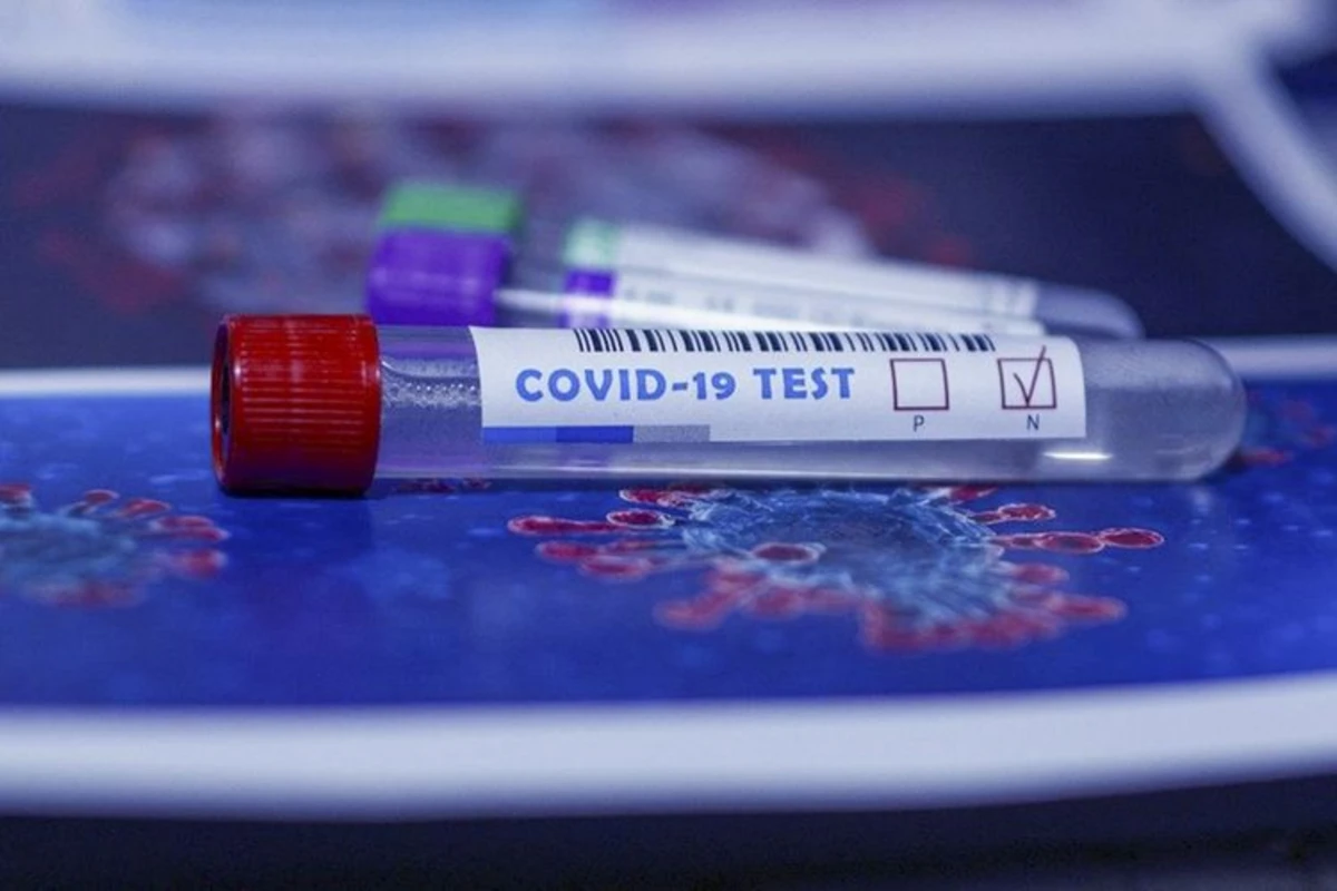 Ölkə üzrə COVID-19-a yoluxma statistikası açıqlanıb
