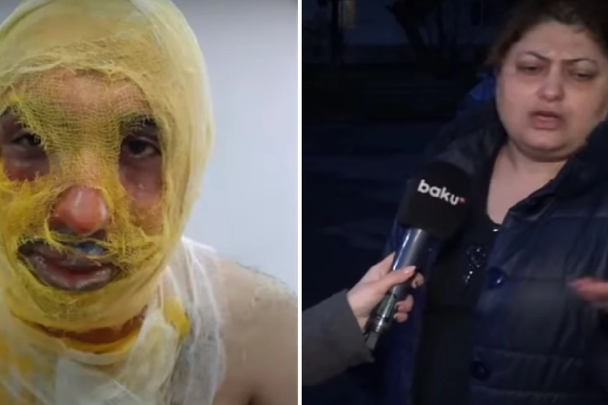Sevgilisinin ailəsi tərəfindən yandırılan oğlanın anası danışdı: “Boğazını da kəsmək istəyiblər” - VİDEO