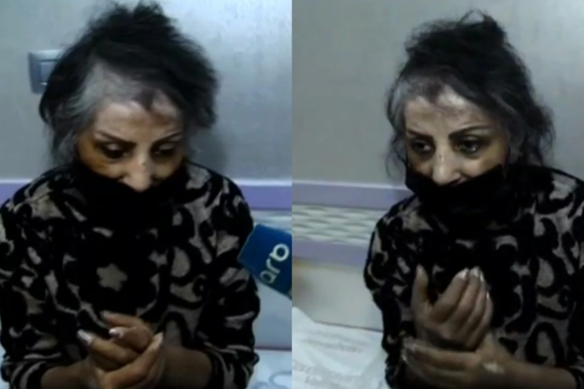 Zöhrə Abdullayeva xəstəxanaya yerləşdirilib - FOTO