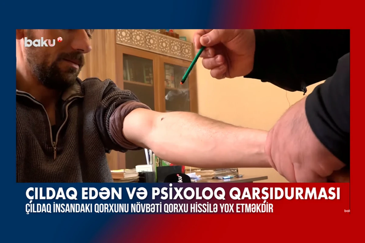 “Çıldaq müalicəsi”: Qorxudan xilas olmaq, yoxsa bəd nəzəri uzaqlaşdırmaq? - VİDEO