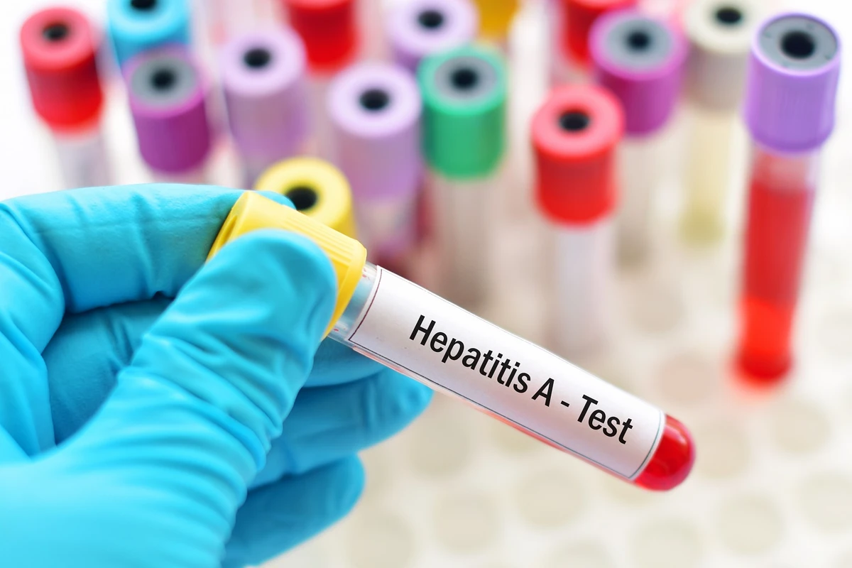 Azərbaycanda hepatit xəstəliyindən ölənlərin sayı açıqlandı