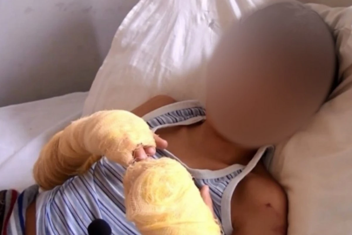 Bərdədə uşağın əllərini yandıran ana barədə cinayət işi açıldı