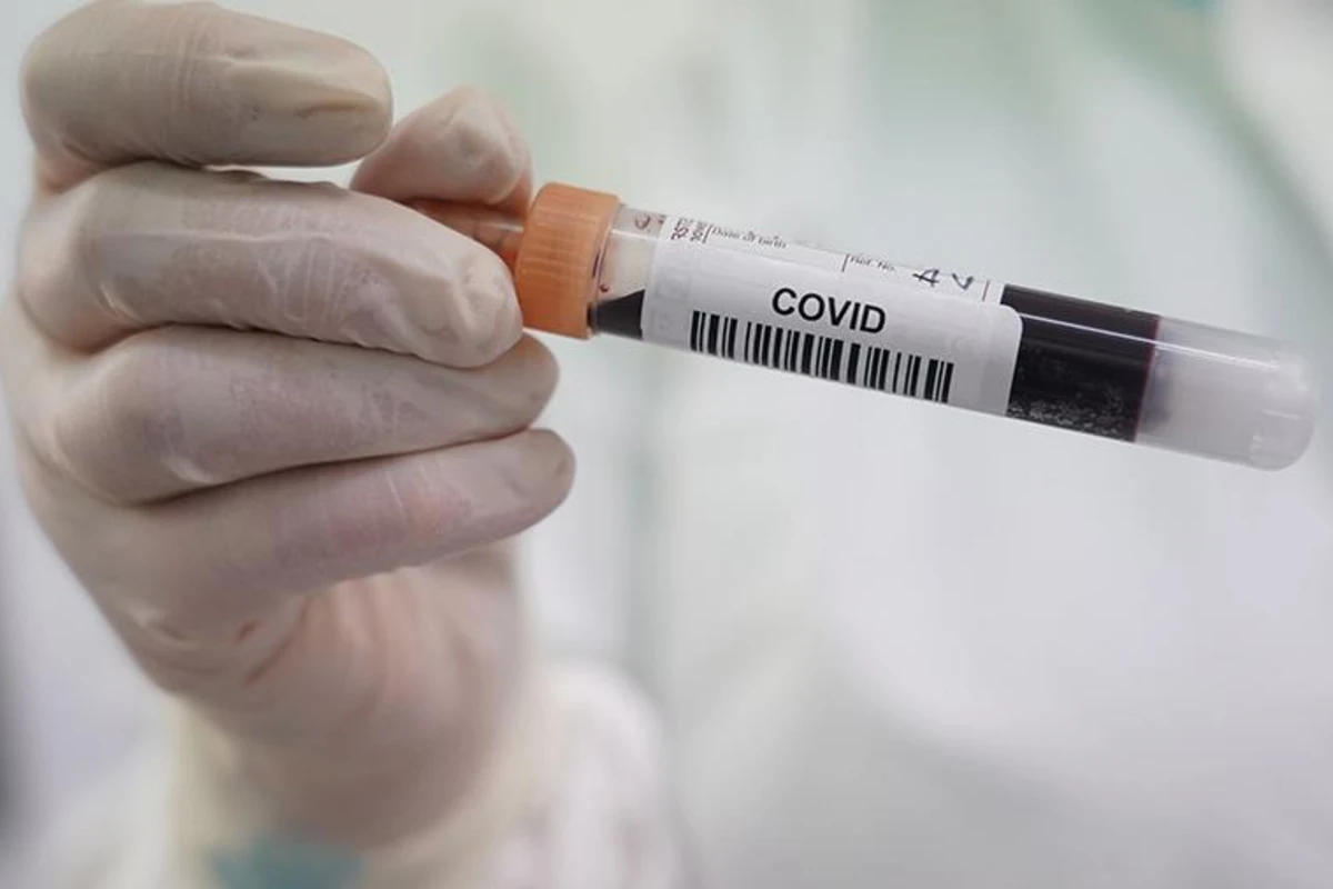 Американский ученый предупредил об угрозе COVID-26 и COVID-32