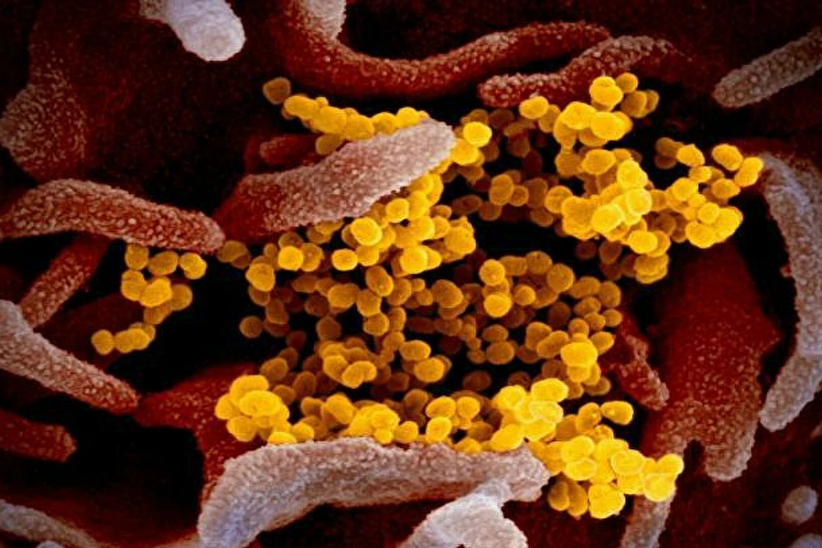 Экономист объяснила, для каких стран опасен штамм дельта