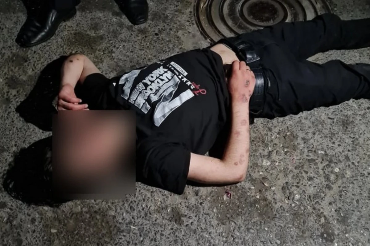 Patı qəbul edən gənc küçədə komaya düşdü