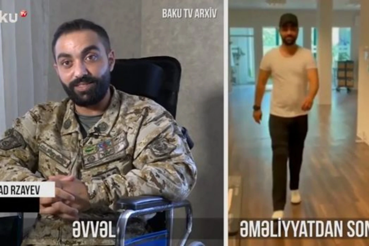 Участник Отечественной войны, лишившейся обеих ног, обеспечен протезами - ВИДЕО