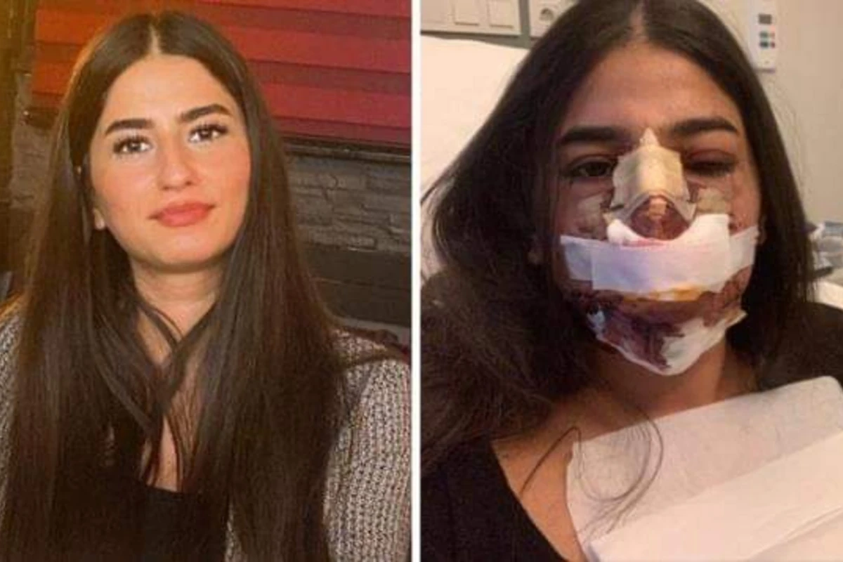 Gənc qızı tanınmaz hala salan cərrah onu lağa qoydu - FOTO