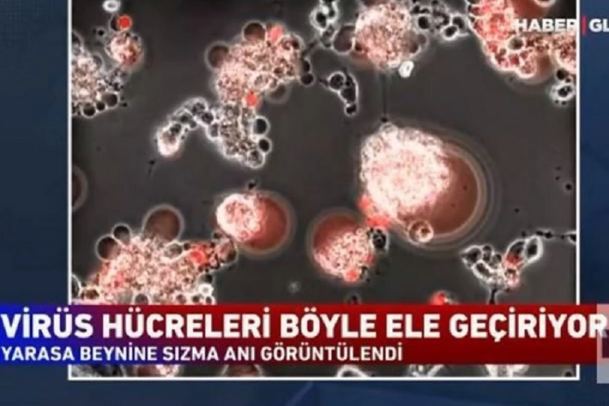 Koronavirus hüceyrələrə belə daxil olur - ANBAAN VİDEO