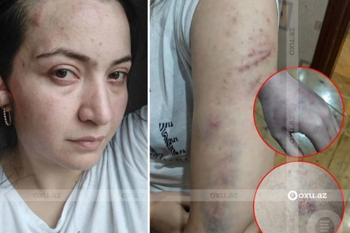 Брат женщины, которую муж застрелил в отделе полиции, раскрыл некоторые подробности