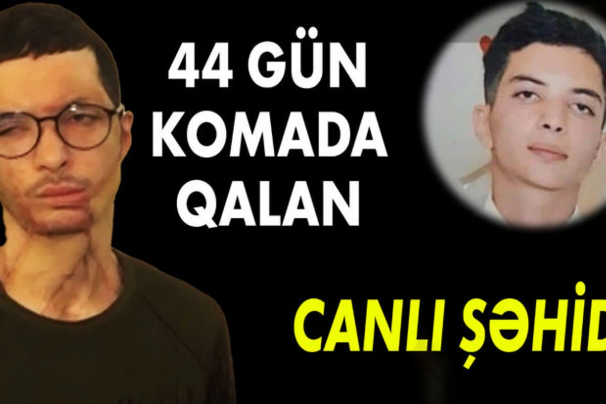 Müharibədə yanında minamyot mərmisi partladı, tanınmaz hala düşdü - VİDEO Müharibədə yanında minamyot mərmisi partladı, tanınmaz hala düşdü - VİDEO