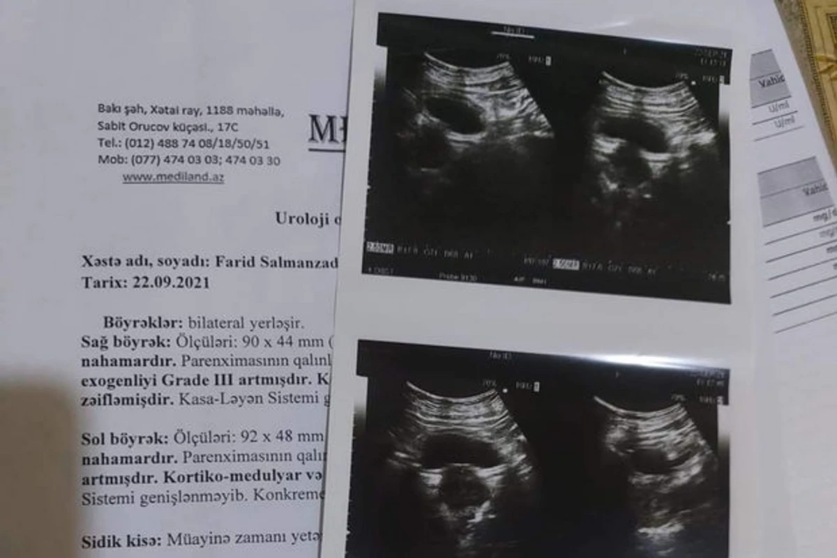 41 yaşlı Fəridin sizin köməyinizə ehtiyacı var - FOTO