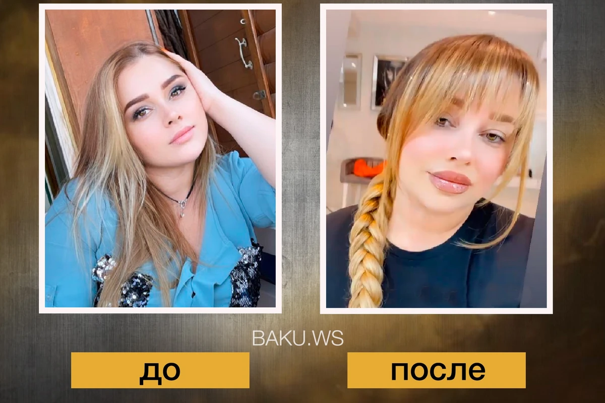 Поклонников Хатиры Ислам поразила ее внешность после пластики - ФОТО ДО И ПОСЛЕ Поклонников Хатиры Ислам поразила ее внешность после пластики - ФОТО ДО И ПОСЛЕ
