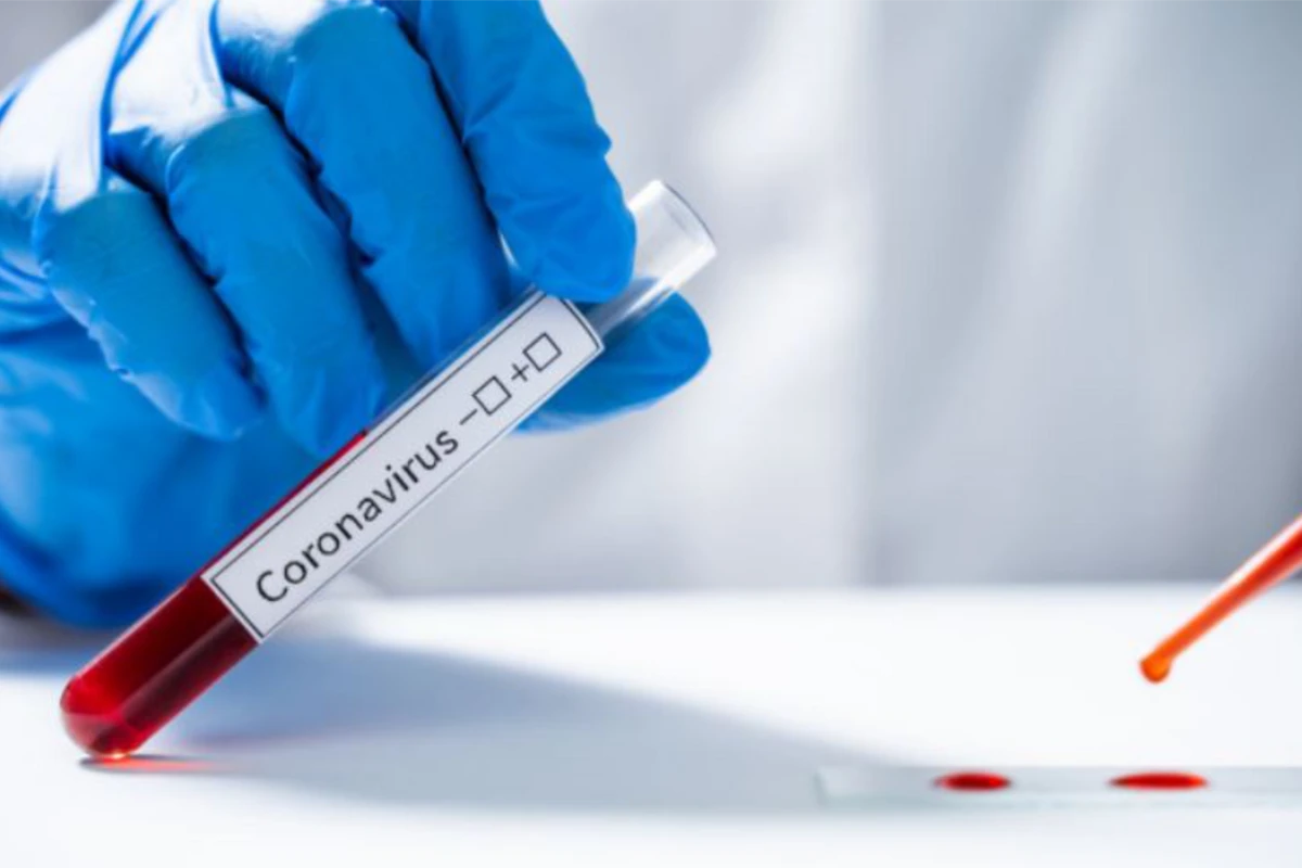 Azərbaycanda koronavirusa yoluxanların gündəlik statistikası açıqlanıb
