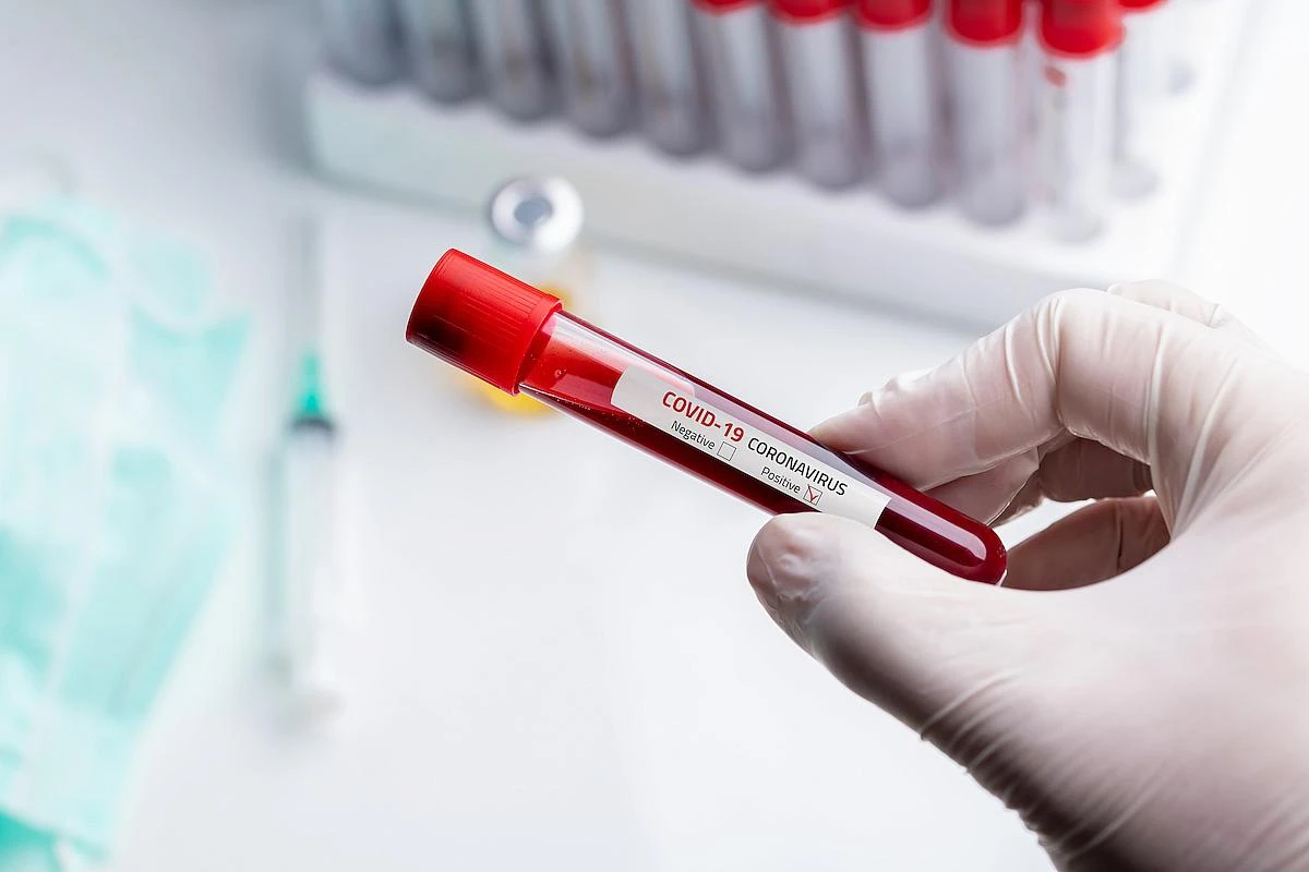 Названо число заразившихся коронавирусом в Азербайджане за сегодня - ФОТО