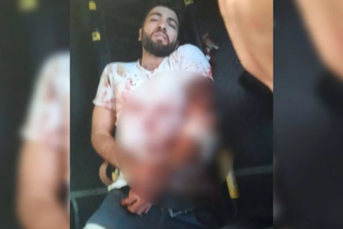 Ermənilərin açdığı atəş nəticəsində “Azercell”in əməkdaşı yaralandı – FOTO