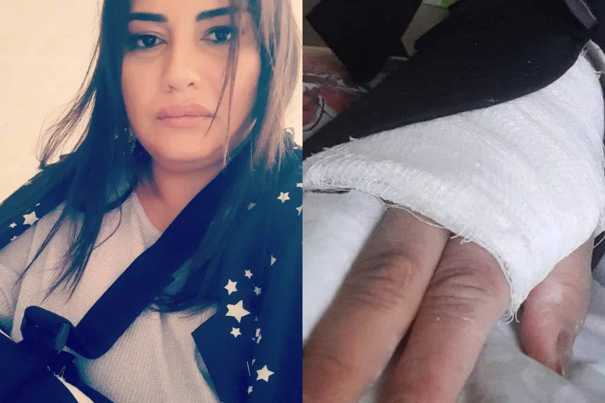 Azərbaycanlı aparıcının qolu sındı: Ağrıkəsici olmadan mümkün deyil - FOTO