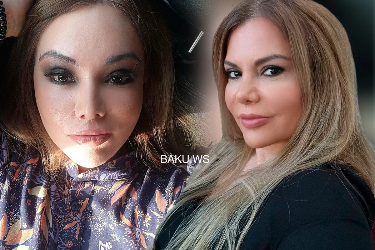 Ulvira Qarayeva plastik əməliyyatdan sonra TANINMAZ HALDA - FOTO Ulvira Qarayeva plastik əməliyyatdan sonra TANINMAZ HALDA - FOTO