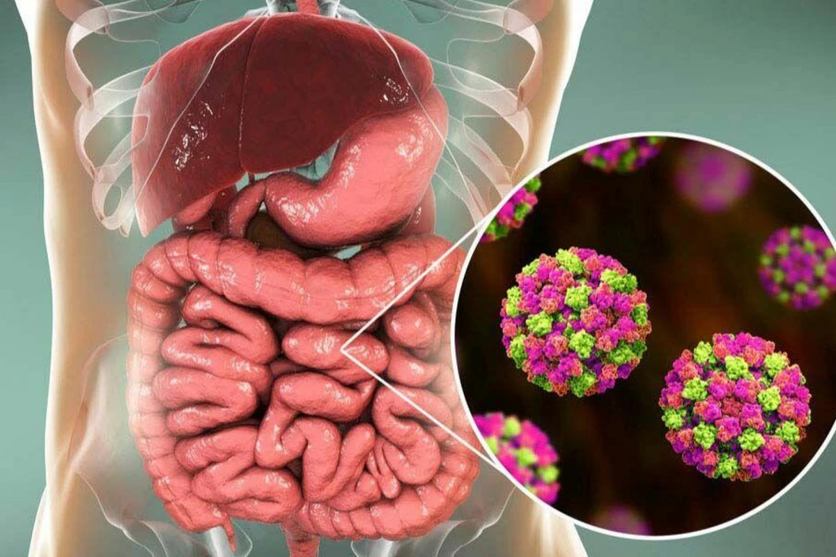 Koronavirus birbaşa mədə-bağırsaq sisteminə təsir edir