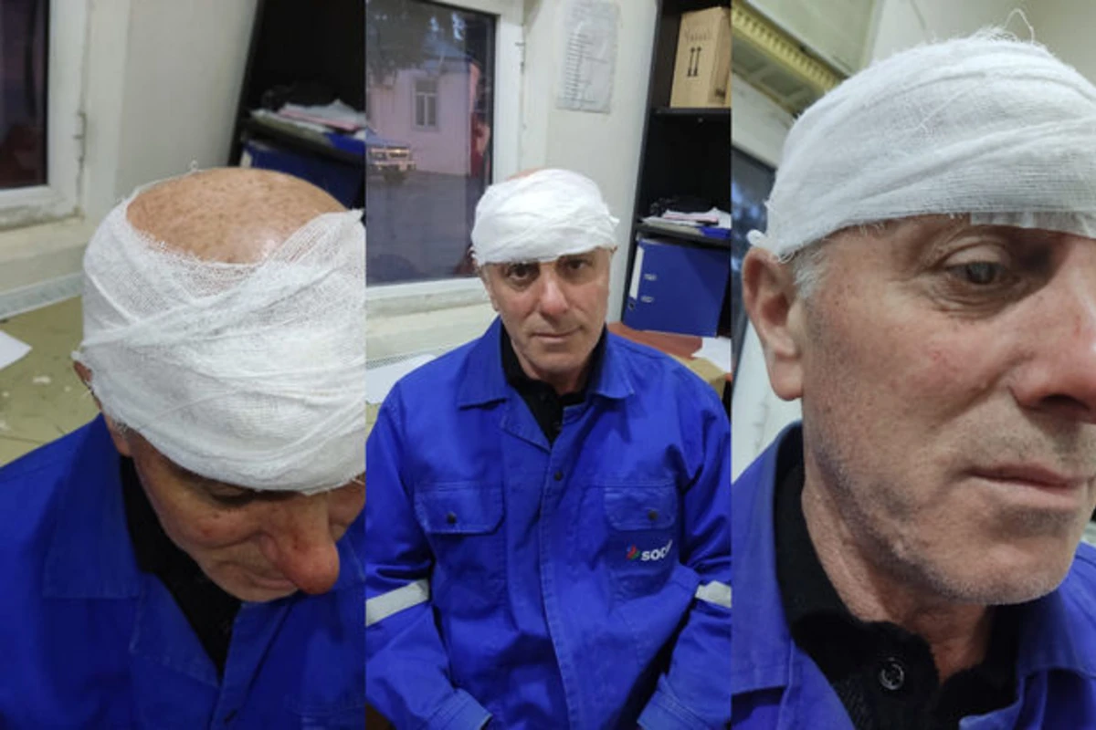 “Azəriqaz”ın işçisi döyüldü