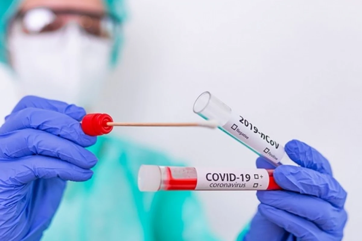 За последние сутки смертельных случаев от COVID-19 не зарегистрировано - ФОТО